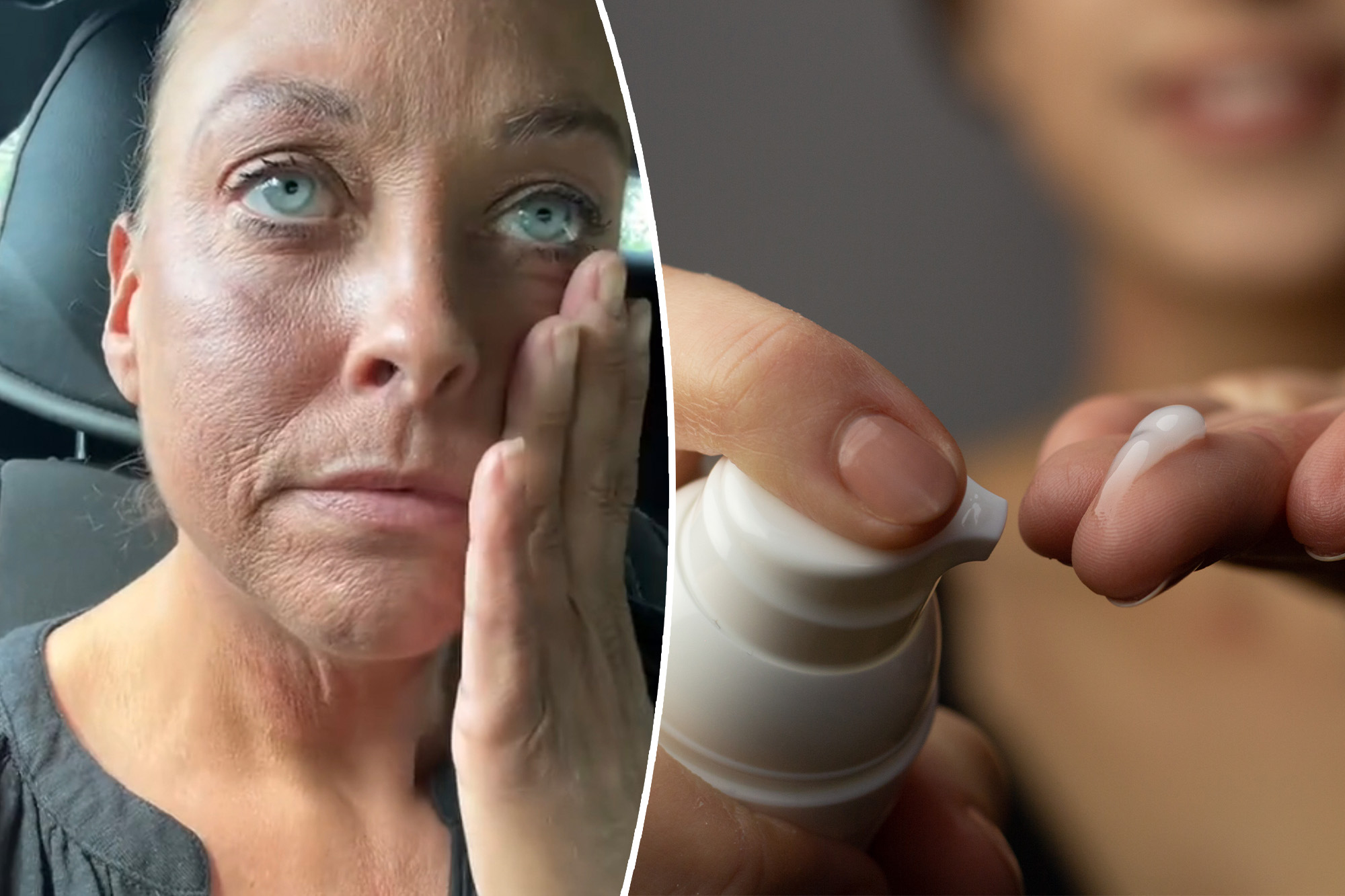 Skincare fan’s PSA as popular product leaves her face burning and wrinkly: ‘I look 80 years old’