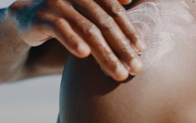  Skin cancer prevention tips for people with dark skin