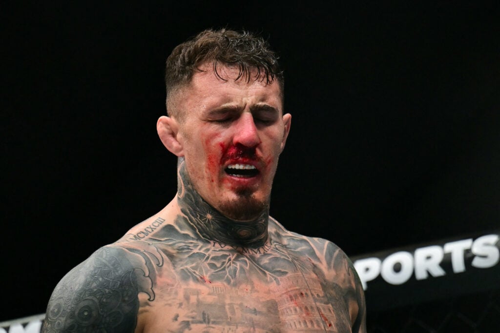 ‘Bad look’… Tom Aspinall accused of being ‘whiny’ about eye poke by UFC legend