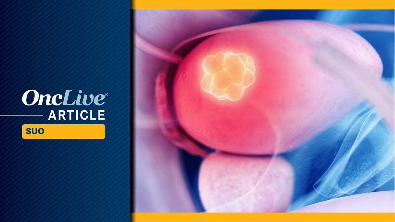 Gemcitabine Intravesical System Yields Low Rates of Radical Cystectomy in BCG-Unresponsive, High-Risk NMIBC)