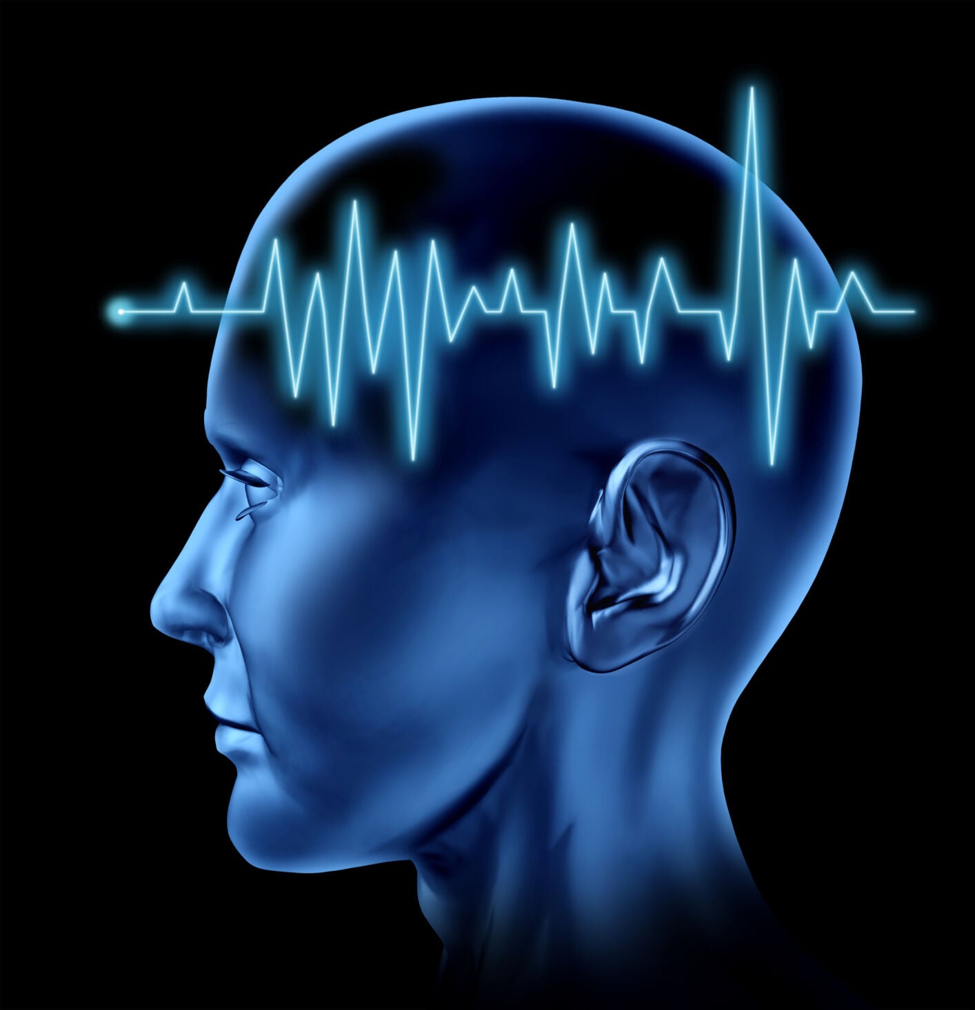 Recognize the sudden warning signs of stroke — and BE FAST