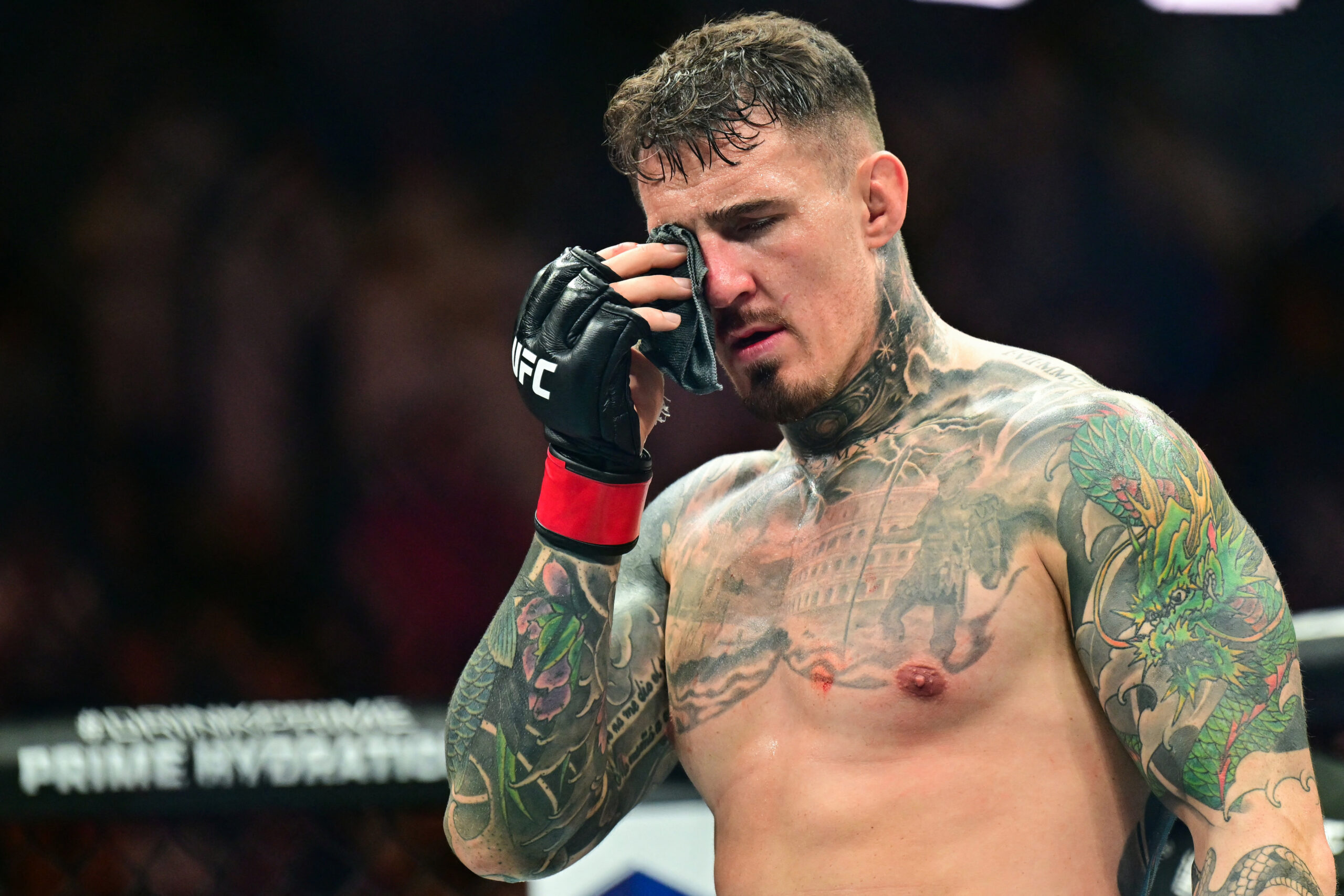 Tom Aspinall reflects on fan backlash to eye poke injuries, says eye surgery worse than vasectomy