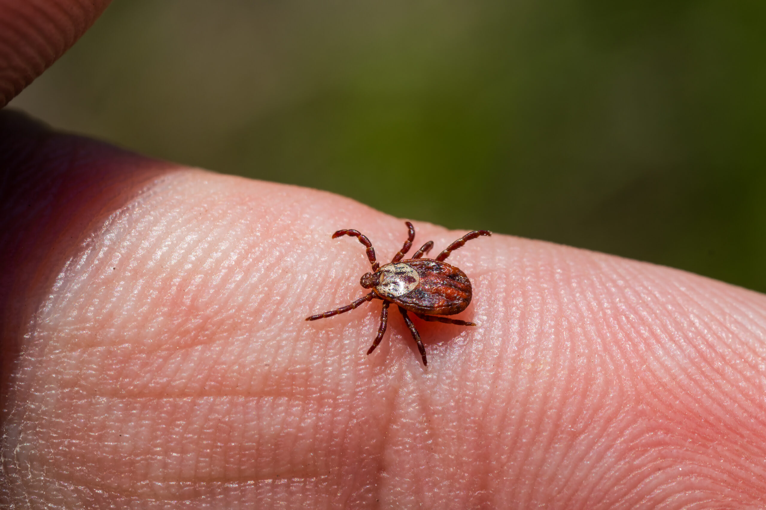 TikTok’s tick-removal tricks to skip — and how to avoid ‘mouthparts left behind in the skin’